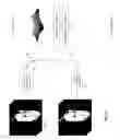Fig. 03 - Isotropic volume reconstruction from multiple 2D scans using super-resolution techniques
