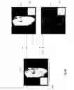Fig. 06 - Isotropic volume reconstruction from multiple 2D scans using super-resolution techniques