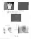 Fig. 12 - Edge enhancement for thermal-visible combined images and cameras