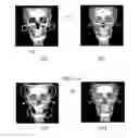 Fig. 01 - PROCESSING MEDICAL VOLUME DATA
