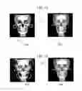 Fig. 10 - PROCESSING MEDICAL VOLUME DATA