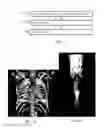 Fig. 03 - Illumination in rendering of anatomy with functional information