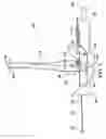Fig. 04 - Winch apparatus and method of use thereof