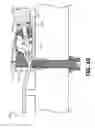 Fig. 11 - Guitar string tuning and anchor system