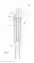 Fig. 06 - Musical instrument actuators and methods for actuating a musical instrument