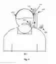 Fig. 05 - Method and device for mitigating wind noise in a speech signal generated at a microphone of the device