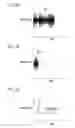 Fig. 05 - Noise reduction device, noise reduction method, and noise reduction program