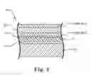 Fig. 04 - Memory cell having closed curve structure