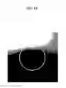 Fig. 15 - Endoscope