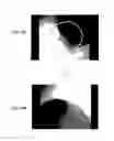Fig. 19 - Endoscope