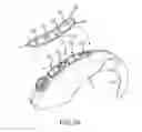 Fig. 07 - Systems and methods for improving output signals from auditory prostheses