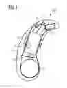 Fig. 02 - Hearing aid and method for producing a hearing aid