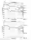 Fig. 06 - Headphone response measurement and equalization
