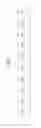 Fig. 16 - Method of transmitting and receiving downlink signal in wireless communication system and apparatus therefor