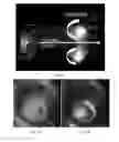 Fig. 06 - Systems and methods to generate a self-confined high density air plasma