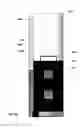 Fig. 08 - Immersion cooling system with low fluid loss