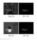 Fig. 04 - ANTIMICROBIAL PEPTIDES DERIVED FROM PHAGE OF ACINETOBACTER BAUMANNII AND USE THEREOF