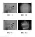 Fig. 05 - ANTIMICROBIAL PEPTIDES DERIVED FROM PHAGE OF ACINETOBACTER BAUMANNII AND USE THEREOF