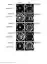 Fig. 07 - ANTIMICROBIAL COMPOSITIONS AND METHODS AND USES THEREOF