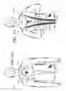 Fig. 11 - Motion-activated venting system