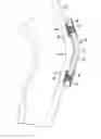 Fig. 01 - PROTECTIVE PAD ASSEMBLY, AND RELATED KITS, APPLICATIONS, AND METHODS