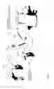Fig. 15 - HEAD AND NECK PROTECTION APPARATUS