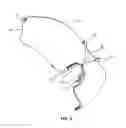 Fig. 04 - Safety glasses deployment system