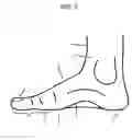 Fig. 03 - Modified shoe permitting forefoot extension for natural supination and pronation