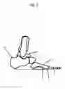 Fig. 06 - Modified shoe permitting forefoot extension for natural supination and pronation