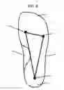 Fig. 09 - Modified shoe permitting forefoot extension for natural supination and pronation