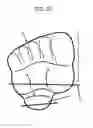 Fig. 13 - Modified shoe permitting forefoot extension for natural supination and pronation