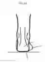 Fig. 16 - Modified shoe permitting forefoot extension for natural supination and pronation
