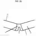 Fig. 27 - Modified shoe permitting forefoot extension for natural supination and pronation