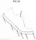 Fig. 31 - Modified shoe permitting forefoot extension for natural supination and pronation
