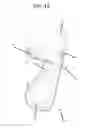 Fig. 33 - Modified shoe permitting forefoot extension for natural supination and pronation