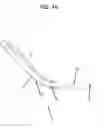 Fig. 47 - Modified shoe permitting forefoot extension for natural supination and pronation