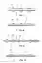 Fig. 05 - Elastic coreless rope belt