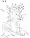 Fig. 10 - Pressure-venting container