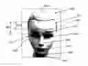Fig. 01 - Methods, systems and instruments for creating partial model of a head for use in hair transplantation