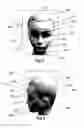 Fig. 04 - Methods, systems and instruments for creating partial model of a head for use in hair transplantation