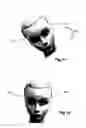 Fig. 07 - Methods, systems and instruments for creating partial model of a head for use in hair transplantation