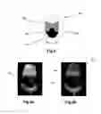 Fig. 08 - Methods, systems and instruments for creating partial model of a head for use in hair transplantation
