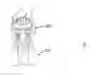 Fig. 01 - Device for carrying a plurality of handbags
