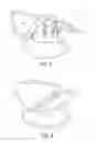 Fig. 05 - Wrist and forearm support device