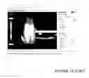 Fig. 10 - Wrist and forearm support device