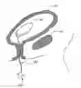 Fig. 01 - METHOD OF REMOVING AN INFLATED IMPLANT FROM A BLADDER