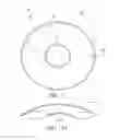 Fig. 14 - METHOD OF REMOVING AN INFLATED IMPLANT FROM A BLADDER