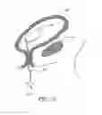 Fig. 22 - METHOD OF REMOVING AN INFLATED IMPLANT FROM A BLADDER