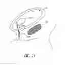 Fig. 23 - METHOD OF REMOVING AN INFLATED IMPLANT FROM A BLADDER