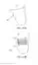 Fig. 29 - METHOD OF REMOVING AN INFLATED IMPLANT FROM A BLADDER